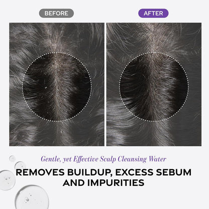 Dr. Groot Scalp Revitalizing Solution Scalp Exfoliating Detox Water